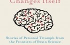 The Brain that changes itself